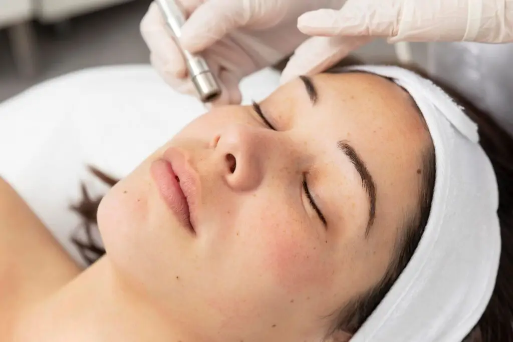 Oxybrazja złuszczanie wodno tlenowe | RosaMed Clinic