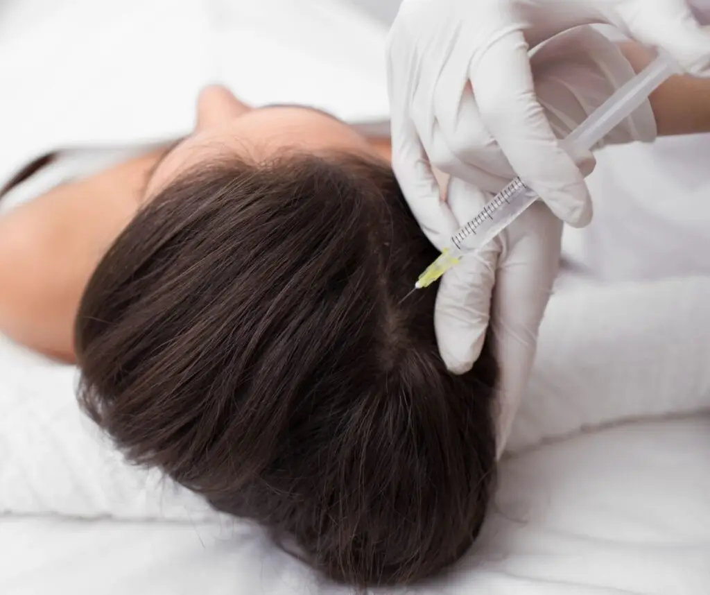 Zdjęcie prezentujące zabieg mezoterapii igłowej skóry głowy - RosaMed Clinic Warszawa