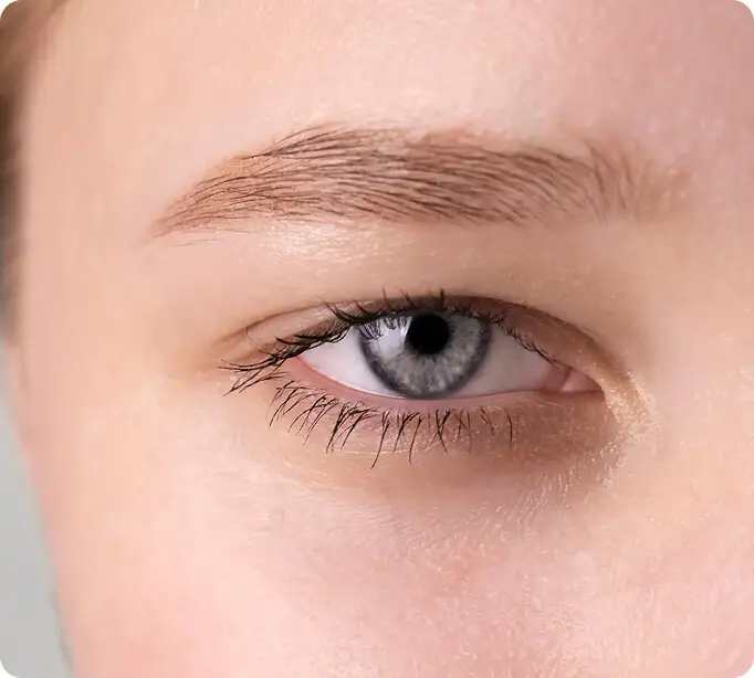 Blefaroplastyka powiek | Rosamed Clinic